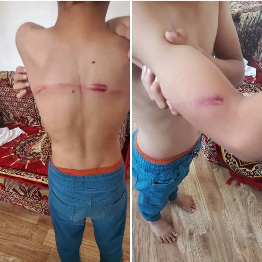 بسبب لا يصدق..مدير مركز لتحفيظ القرآن الكريم يعتدي على طالبين في مأرب(صورة مرعبة)