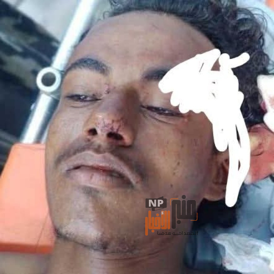 دعوات للتعرف على شاب تعرض لحادث مروع في الحديدة