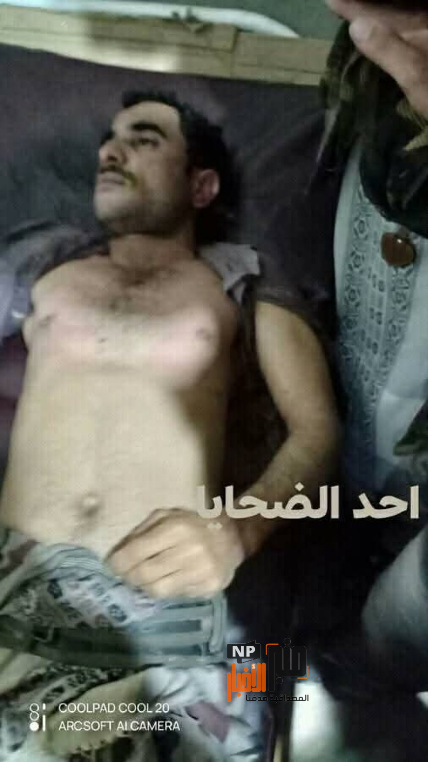 عاجل: موقع منبر الاخبار ينشر أسماء توفيا اختناقاً داخل بئر في إب