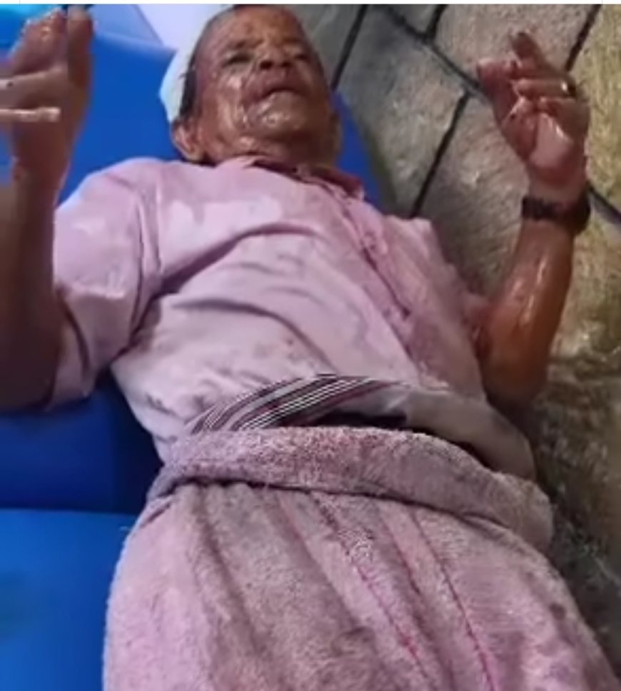 في مشهد مؤلم يهز الضمير.. الاعتداء بالزيت الحار على بائع الزلابيا في إب يثير موجة غضب واسعة