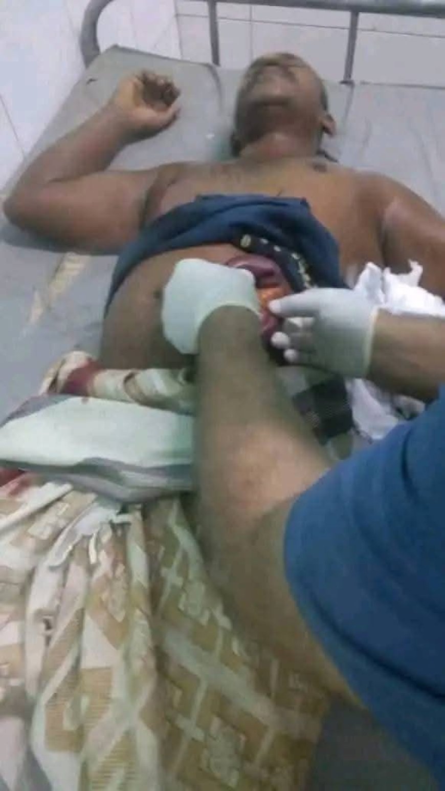عاجل: جريمة أسرية تهز طور الباحة..شاب يطعن والده بسبب خلاف بسيط