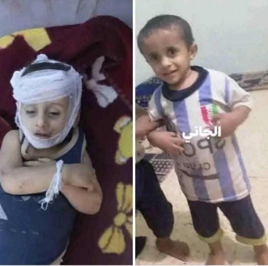 صادم في مأرب.. "أصغر قضية قتل" تحدث في اليمن