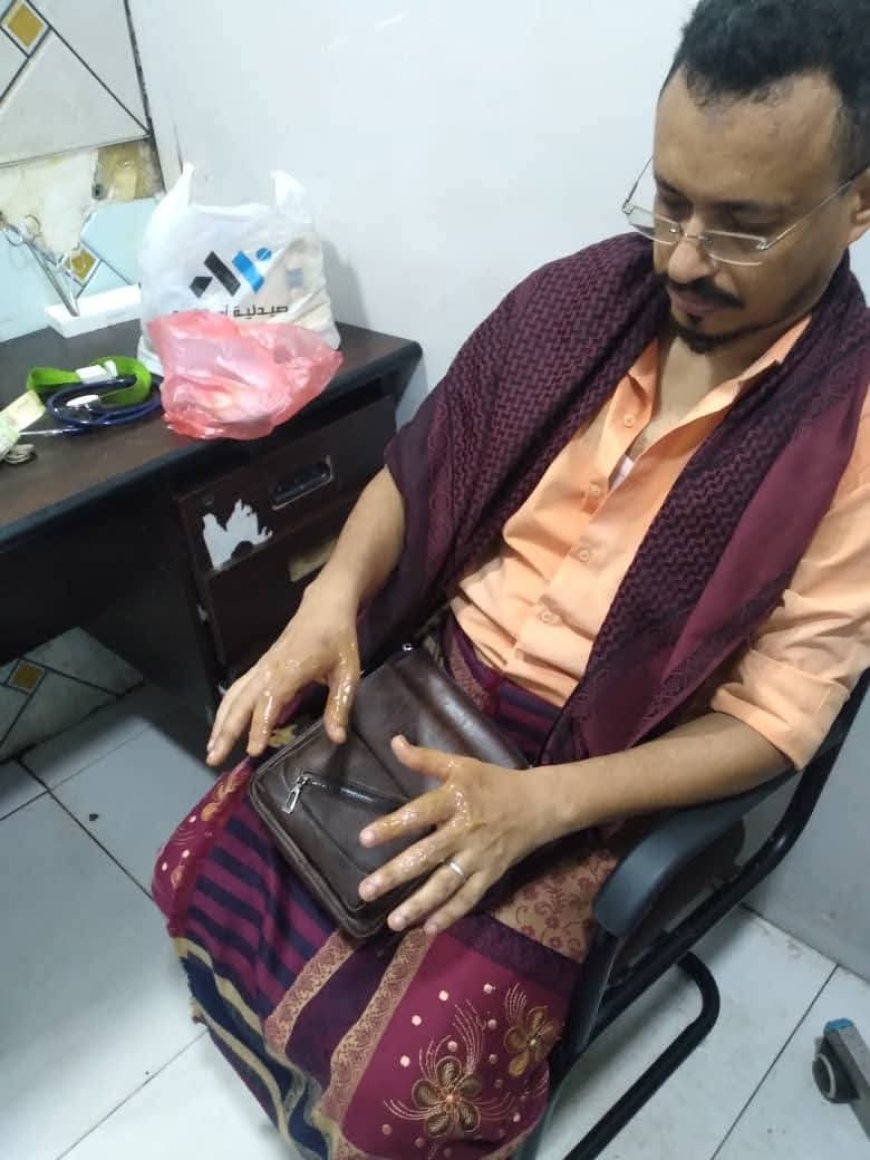 إصابة مؤلمة للصحفي ماجد الكحلي أثناء تعبئة غاز منزلي في عدن