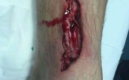 مواجهات مسلحة في مخيم الهضبة وسقوط مصابين حالة بعضهم حرجة...