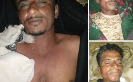 حادثة مؤلمة تشهدها قرية في ريف مديرية حيس جنوب الحديدة ...