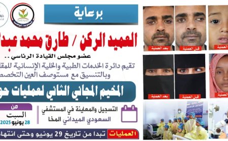 برعاية العميد الركن طارق صالح..الإعلان عن المخيم المجاني الثاني لجراحة حول العين في المخاء