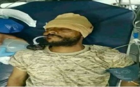 استشهاد أحد أبطال القوات الجنوبية متأثرًا بإصابته برصاص قناص حو,,ثي في جبهة الضالع...