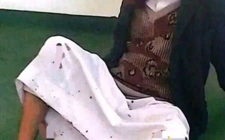 مليشيا الحو,,ثي تعتدي على الاهنومي إمام مسجد التقوى في ذمار...