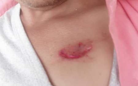 مجددا كلاب مسعورة تهاجم مواطنين في الضالع ...