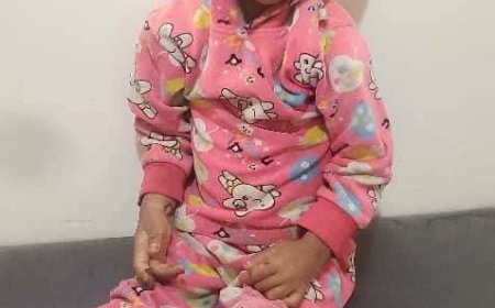 صرخة "أفراح" تهز اليمن.. جريمة تعذيب طفلة حتى الشلل على يد "وحوش بلا رحمة"(صور مرعبة)