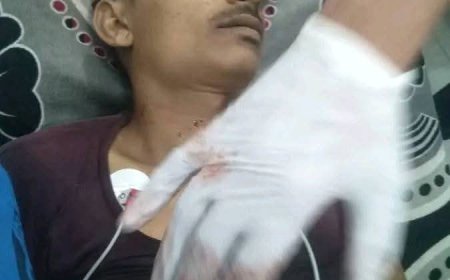 تعاون أمني مثمر يطيح بقاتل "الوزيف" في تعز.. جريمة وحشية تهز الأخمور