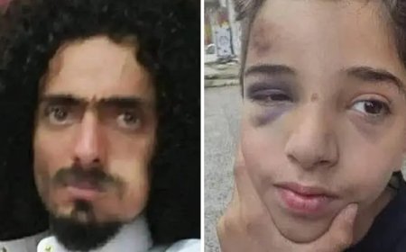 عناصر حو,,ثية يعتدون على طفل في صنعاء بصورة وحشية ...