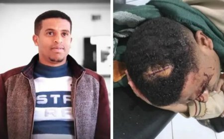 اعتداء غادر على إعلامي في التربة محافظة تعز يثير القلق....