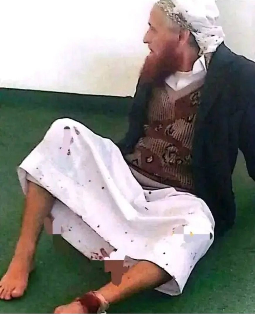 مليشيا الحو,,ثي تعتدي على الاهنومي إمام مسجد التقوى في ذمار...