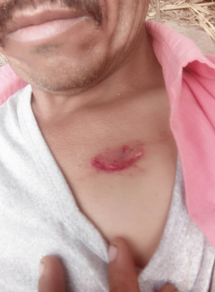 مجددا كلاب مسعورة تهاجم مواطنين في الضالع ...