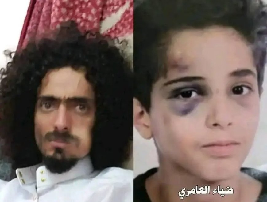 مشائخ ووجهاء مديرية برع بمحافظة الحديدة ينددون بالاعتداء الوحشي على الطفل ضياء في صنعاء ..