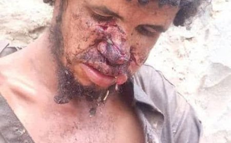 تعز..أمن المعافر يطيح بالمعتدي على “المجنون”.. والكاميرات تكشف هوية الجاني