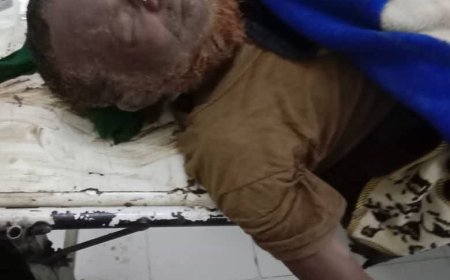 انهيار منزل في مودية جراء الأمطار الغزيرة وإصابة أسرة كاملة