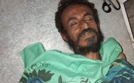 عاجل: وفاة مواطن بلدغة أفعى بالصبيحة لحج ومطالبات بتوفير مضادات التسمم للمرافق الصحية 