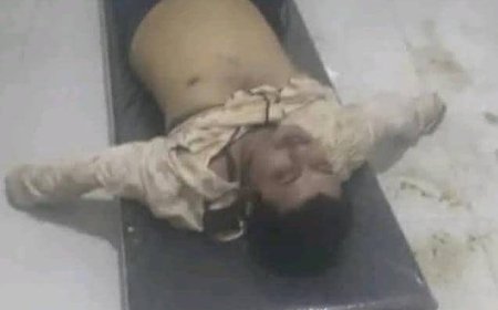 حراك وسط اليمن يستنكر قيام ميليشيات الحوثي بقتل أحد أبناء وصاب ومنع إسعافه(بيان)