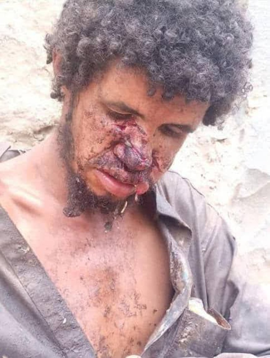 تعز..أمن المعافر يطيح بالمعتدي على “المجنون”.. والكاميرات تكشف هوية الجاني