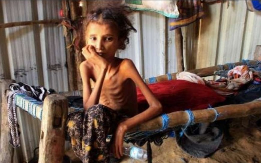 الأمم المتحدة: خطر الجوع يهدد أكثر من 18 مليون يمني..