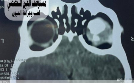 قرار طبي صعب ينقذ حياة طفل في مستوصف العين التخصصي بعدن