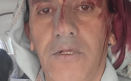 عاجل:اول ظهور لصحفي بارز ينجو من موت محقق خلال القصف الإسرائيلي على مقر صحيفة "26 سبتمبر"(صورة أولية)