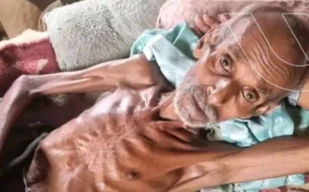 وفاة نازح جوعاً ترفع عدد الضحايا في حجة إلى 3 أشخاص ..