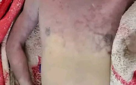 وفاة بائع آيس كريم تحت التعذيب في سجون الح،وثيين بصعدة