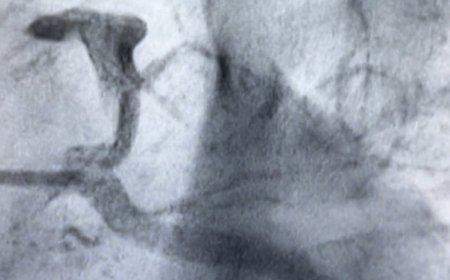 من فراغ قاتل إلى جلطة قلبية.. د. عبدالوهاب الماتري يوجه تحذير هام من مادة غامضة تفتك بشباب اليمن ترفع الضغط وتصيب القلوب الشابة بأزمات مميتة (تعرف عليه )