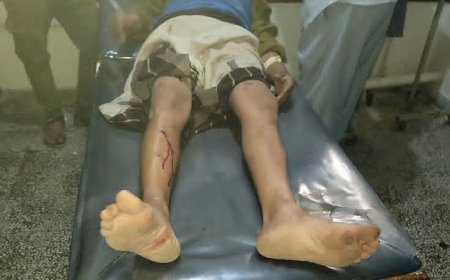 عاجل..الضالع: إصابة مواطن بعد اعتداء مسلح من ملثمين