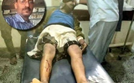 مسلحون يعتدون على طبيب بيطري في الضالع...