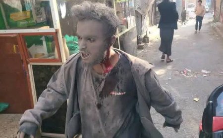 عــاجــل: شاهد اول صورة لمواطن لحظة خروجه من تحت أنقاض غارة إسرائيلية على صنعاء