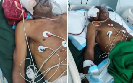 عدن..نقل مسن الى العناية المركزة عقب تعرضه لاعتداء من قبل الاورموا