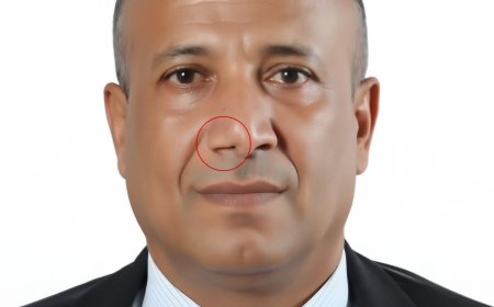 تعز:صورة جديدة لقاتل "مرسال" تكشف قيامه بتغيير ملامحه ومكافأة مالية لمن يدلي بمعلومات