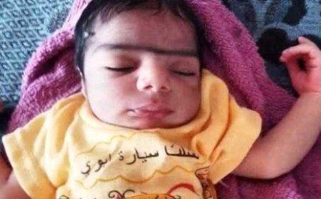 مواطن يعثر على رضيع في كيلو 16 شرق  مدينة الحديدة ...
