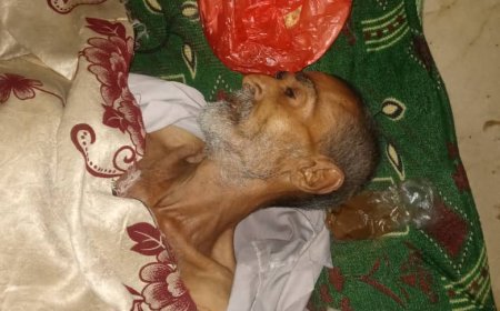 صور..مستشفى الثورة بتعز يناشد ذوي المتوفى "جواد المعمري" للحضور واستلام الجثمان