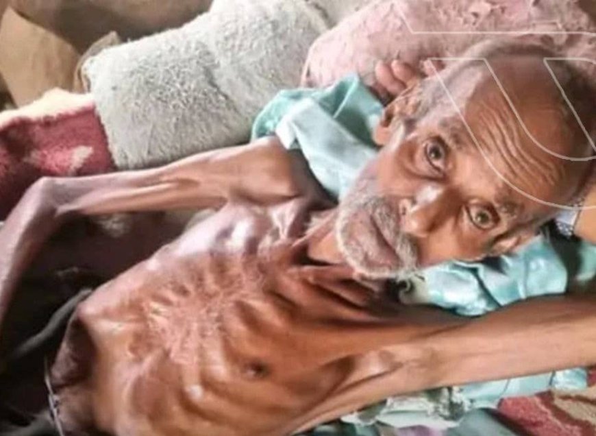 وفاة نازح جوعاً ترفع عدد الضحايا في حجة إلى 3 أشخاص ..