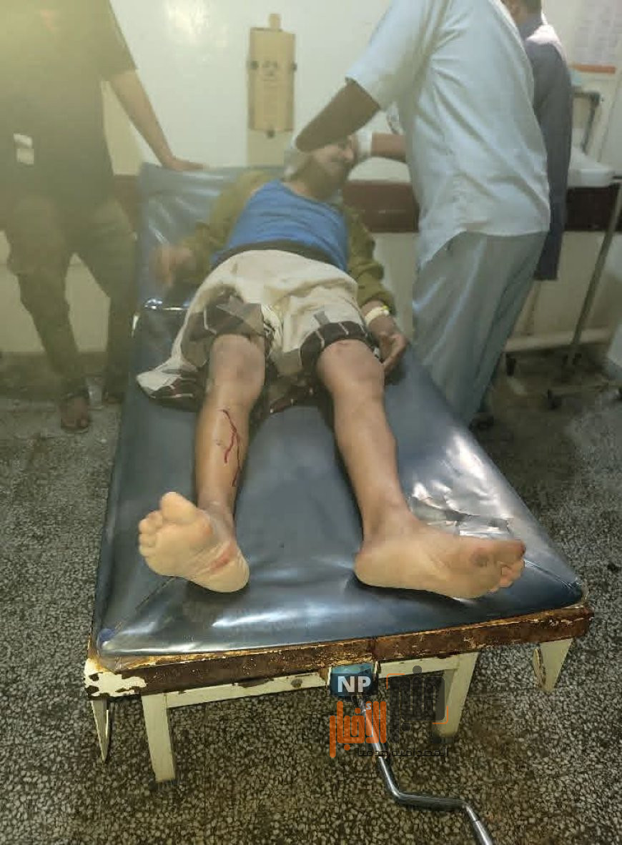 عاجل..الضالع: إصابة مواطن بعد اعتداء مسلح من ملثمين