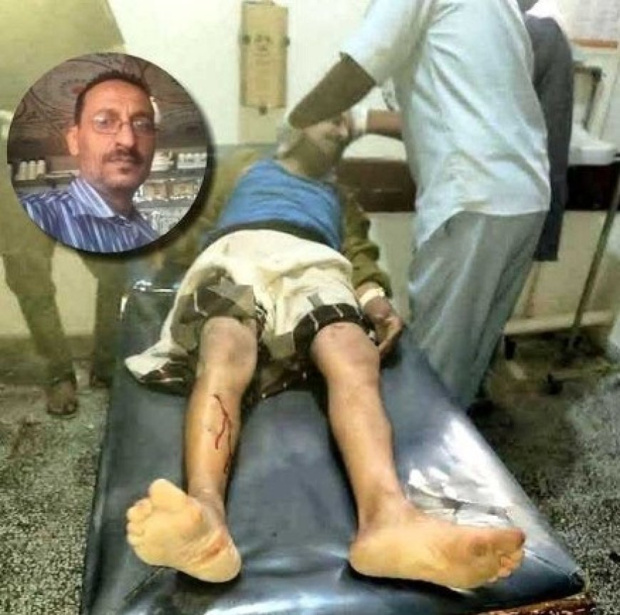 مسلحون يعتدون على طبيب بيطري في الضالع...