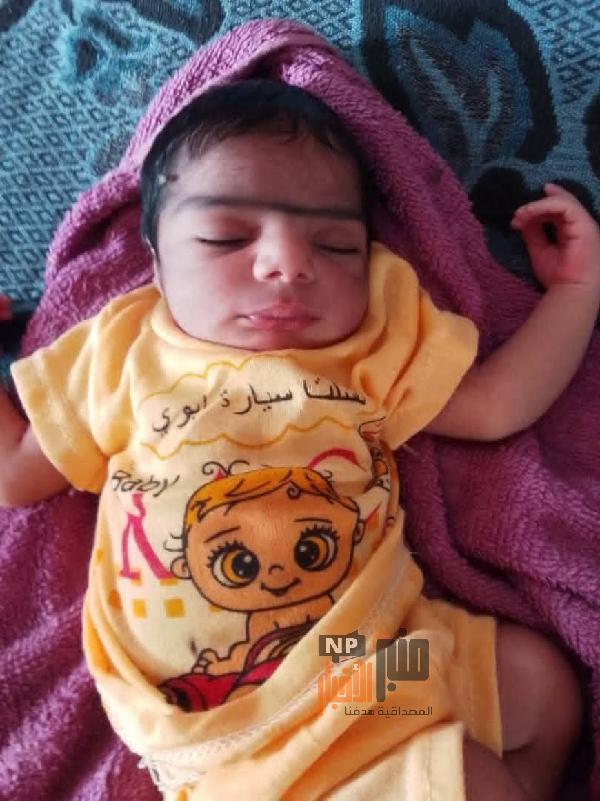العثور على رضيع حديث الولادة مرمياً بجوار الطريق في الحديدة(صورة)