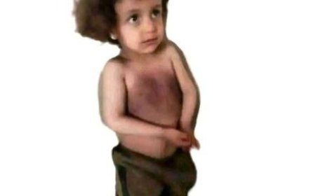 مقتل طفل في إب بعد تعرضه لتعذيب وحشي على يد إخوته....