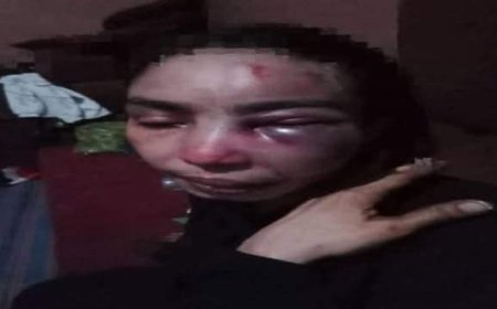امرأة تُعذب بوحشية على يد طليقها العسكري أمام الناس في تعز...