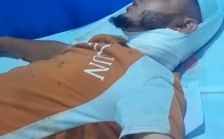 الاتحاد العالمي للمهاجرين اليمنيين يوجه مناشدة عاجلة إلى القيادة الصومالية بشأن الاعتداء على مهاجر يمني...