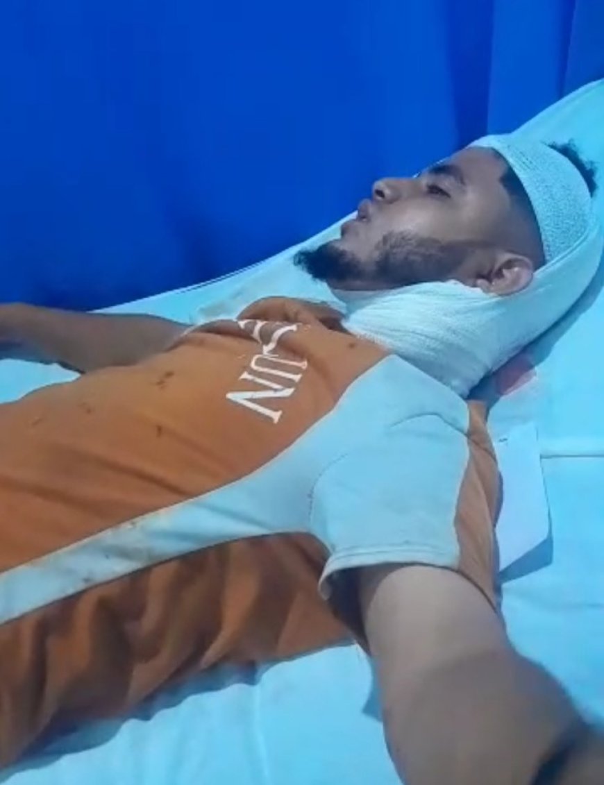 الاتحاد العالمي للمهاجرين اليمنيين يوجه مناشدة عاجلة إلى القيادة الصومالية بشأن الاعتداء على مهاجر يمني...