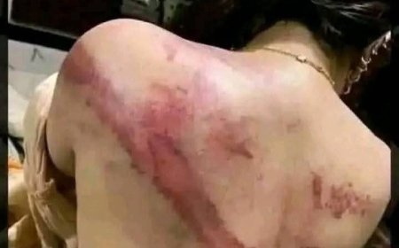 تنديد بمعاناة النساء في سجون الحو...ثيين بصنعاء..