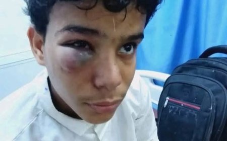 مهاجرون أفارقة يعتدون بوحشية على طفل في حضرموت ...