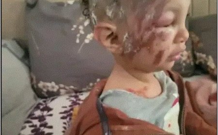 نجاة طفل بأعجوبة من هجوم كلاب ضالة في عمران.....