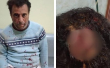 اعتداء وحشي على معاق حركيًا في صنعاء وسط انفلات أمني....